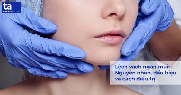 Hình ảnh minh họa các biến chứng phổ biến sau nâng mũi, bao gồm mũi lệch, mũi bóng đỏ, mũi co rút.