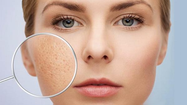 Hướng dẫn cách sử dụng dầu mù u trị sẹo lõm hiệu quả tại nhà