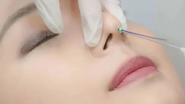 Điều cần cân nhắc khi nâng mũi tại nhà