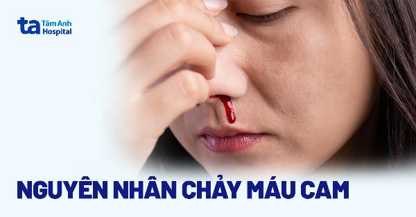 Cảnh báo về việc tự ý uống long huyết sau nâng mũi mà không có chỉ dẫn của bác sĩ chuyên khoa