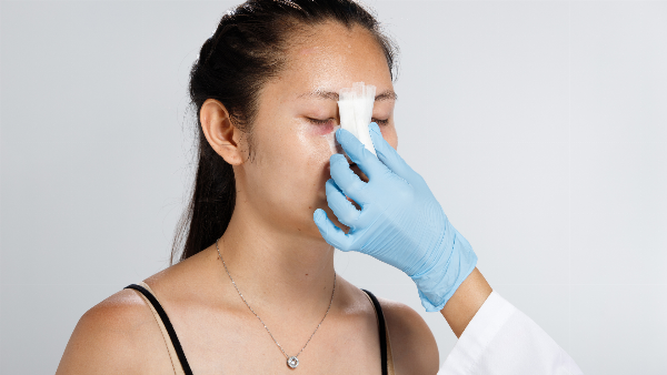 Người bệnh vệ sinh mũi đúng cách sau nâng mũi khi có tiền sử viêm xoang