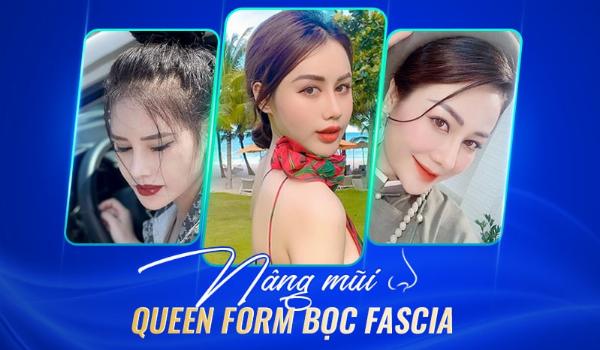 Hướng dẫn chăm sóc sau nâng mũi Queen Form