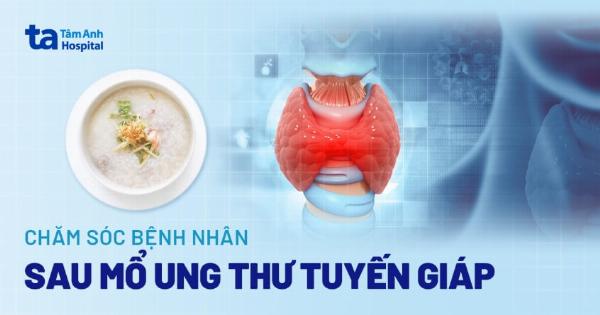Hình ảnh hướng dẫn cách chăm sóc vết mổ đẻ đúng cách: vệ sinh vết mổ, thay băng, tránh vận động mạnh, ăn uống đầy đủ dinh dưỡng