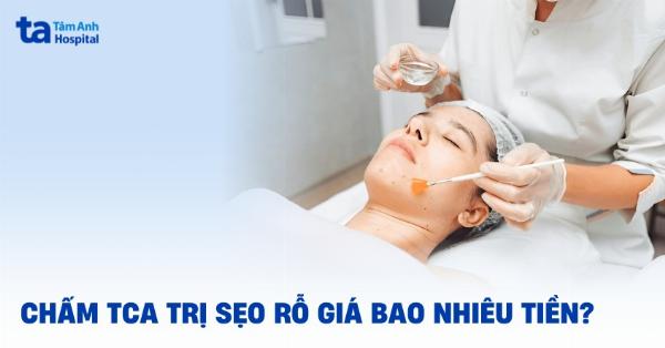 Các yếu tố ảnh hưởng đến chi phí điều trị sẹo rỗ