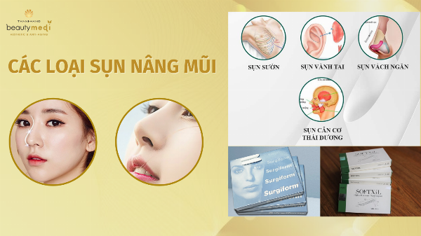 Biểu đồ hoặc hình minh họa so sánh yếu tố ảnh hưởng đến chi phí nâng mũi ergonomic (tình trạng mũi, vật liệu, bác sĩ)