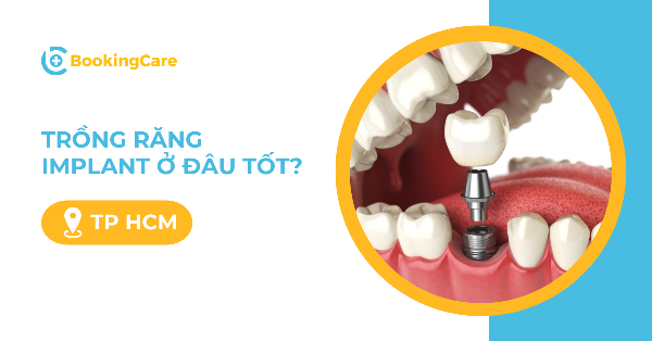 Hình ảnh minh họa các yếu tố ảnh hưởng đến chi phí nâng mũi implant bao gồm vật liệu, bác sĩ và cơ sở vật chất
