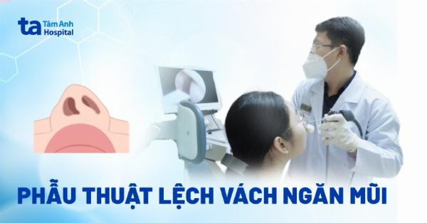 Hình ảnh minh họa yếu tố ảnh hưởng chi phí sửa mũi lệch (ví dụ: mô tả mức độ lệch, loại vật liệu)