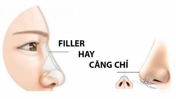 Cơ chế hoạt động của tiêm nâng mũi bằng filler trong thẩm mỹ mũi.