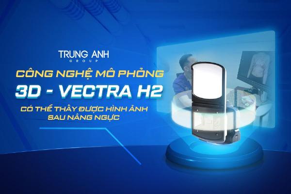 Mô tả hoặc hình ảnh về công nghệ mô phỏng dáng mũi 3D