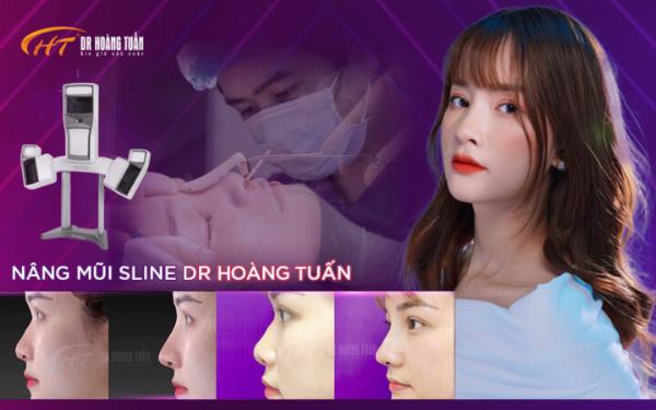 Dáng mũi S-line tự nhiên theo tiêu chuẩn thẩm mỹ hiện đại