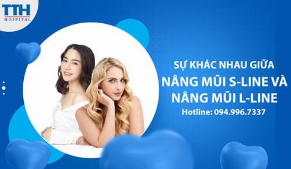 Giải thích dáng mũi S-line và L-line trong thẩm mỹ nâng mũi