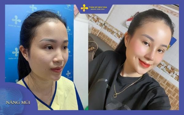 Sơ đồ minh họa dáng mũi S-line lý tưởng phù hợp với khuôn mặt người Á Đông, thể hiện đường cong mềm mại và tỉ lệ hài hòa