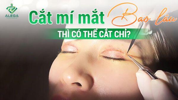Dấu hiệu vết mổ mũi đã sẵn sàng cắt chỉ sau nâng mũi