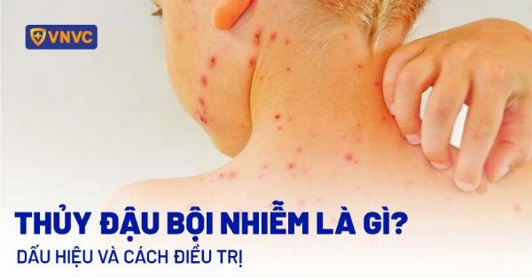 Hình ảnh minh họa dấu hiệu nhiễm trùng mũi sau nâng mũi (đỏ, sưng, có thể có dịch)