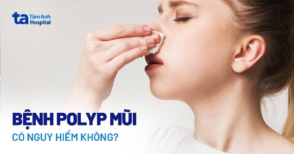Giải phẫu mũi và các xoang cạnh mũi liên quan đến viêm xoang và nâng mũi