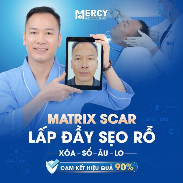 Hình ảnh trước và sau khi trị sẹo rỗ bằng Matrix Cell