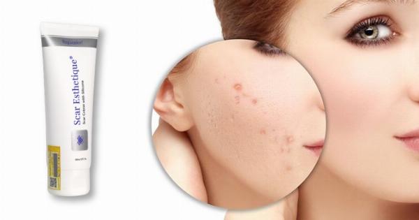 Kem trị sẹo rỗ White Doctors có hiệu quả không, đánh giá từ người dùng và chuyên gia da liễu