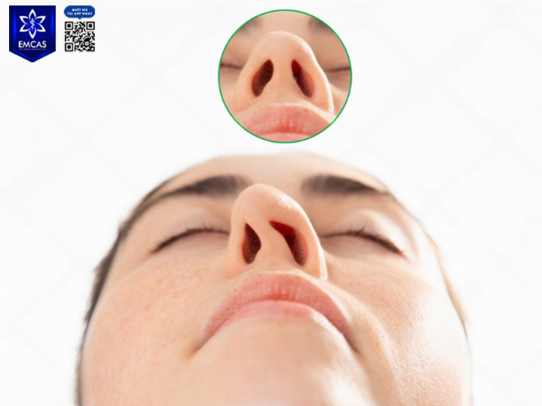 Các kỹ thuật và chất liệu thường dùng trong sửa mũi lần 2