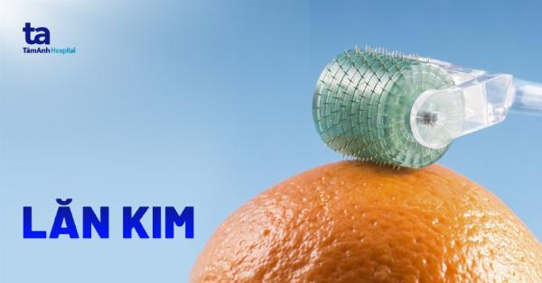 Lăn kim vi điểm là phương pháp kích thích tái tạo da và tăng sinh collagen.
