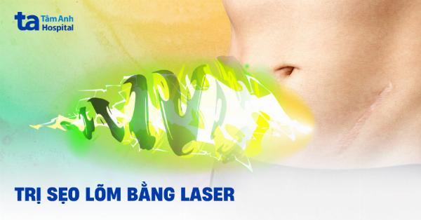 Điều trị sẹo lõm lâu năm bằng Laser Fractional CO2