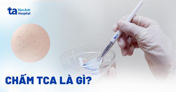 Lưu ý về tác dụng phụ và cách sử dụng kem trị sẹo đáy nhọn đúng cách.