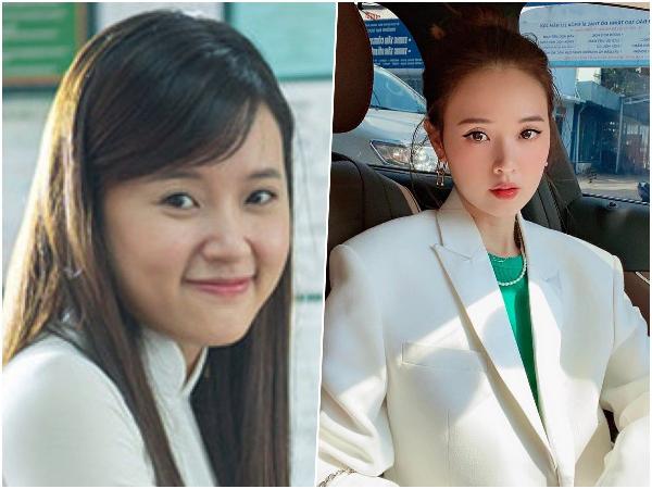 So sánh hình ảnh mũi Midu trước và sau tin đồn sửa mũi dưới góc độ thẩm mỹ