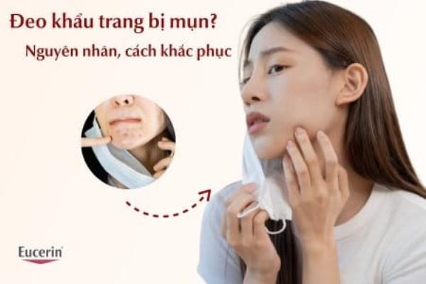 Môi trường ẩm ướt dưới khẩu trang thúc đẩy viêm và kích ứng da mũi
