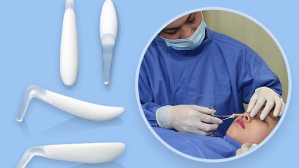 So sánh dáng mũi trước và sau nâng thể hiện kết quả thẩm mỹ thực tế