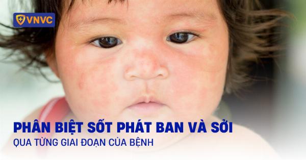 Hinh anh mui hech va cac dac diem nhan biet