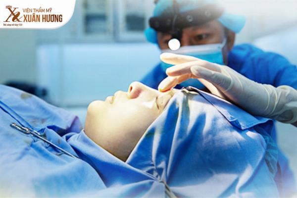 Dáng mũi tự nhiên, hài hòa sau nâng mũi ergonomic tại Phú Xuân, phù hợp với đường nét khuôn mặt