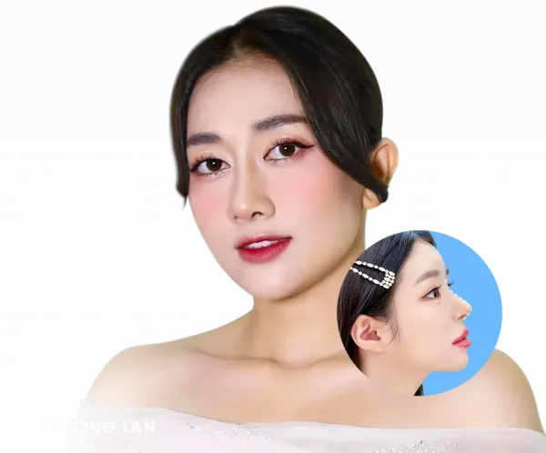 Phân tích nhân trắc học thẩm mỹ mũi