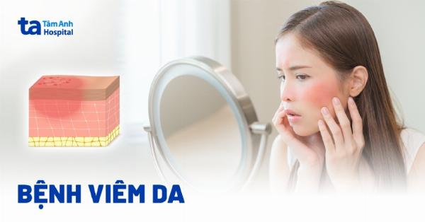 So sánh các nguyên nhân khác nhau gây ngứa da, bao gồm dị ứng, khô da và bệnh da liễu