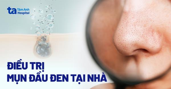 Phòng ngừa sẹo mụn và cách chăm sóc da khoa học