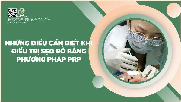 Liệu pháp PRP (huyết tương giàu tiểu cầu) để điều trị sẹo rỗ