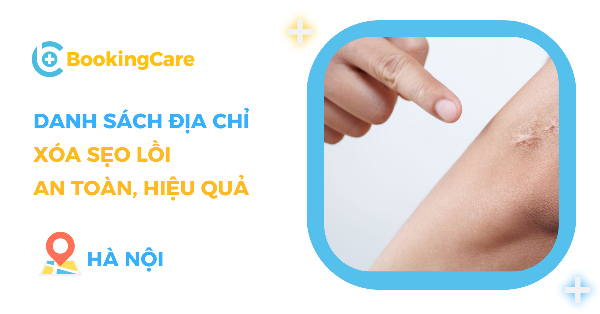 Quy trình cắt sẹo lồi chuẩn y khoa tại Thẩm Mỹ Viện Phú Xuân