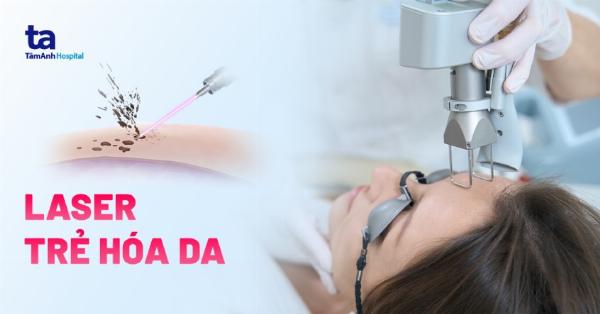 quy-trình-điều-trị-sẹo-lõm-đỏ-tại-phú-xuân-được-thực-hiện-bài-bản