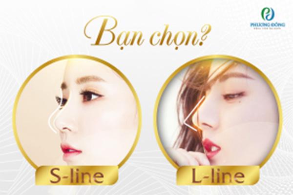 Sơ đồ tổng quan quy trình phẫu thuật nâng mũi cấu trúc/bán cấu trúc