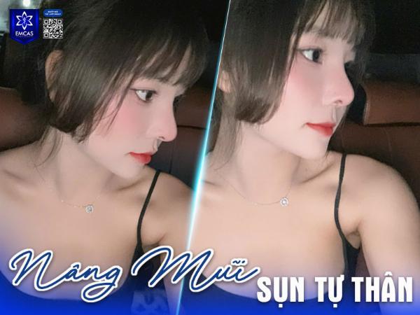 Minh hoa cac buoc trong quy trinh nang mui an toan