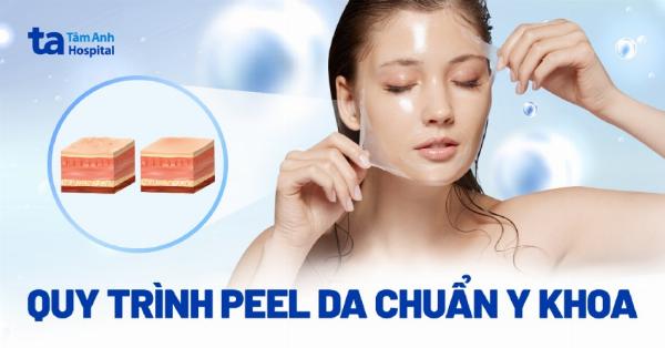 Minh họa các bước trong quy trình nâng mũi chuẩn y khoa