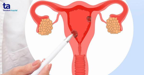 Biểu đồ nguy cơ khi dùng thuốc giảm cân sau nâng mũi