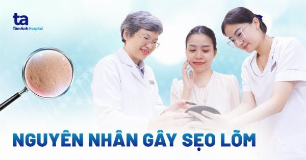 Sẹo chân vuông trên trán hình hộp