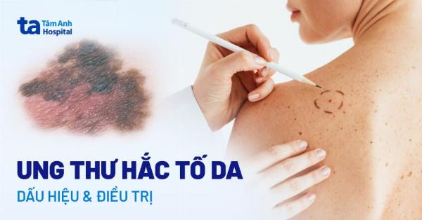 Nguyên nhân sâu xa của sẹo lồi liên quan đến di truyền, yếu tố môi trường và hệ miễn dịch.