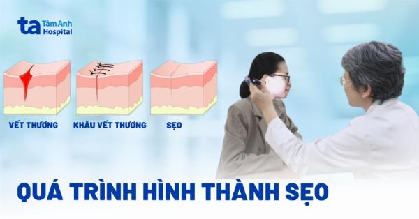 Sẹo lồi ở tay hình thành do tăng sinh collagen quá mức sau tổn thương da.
