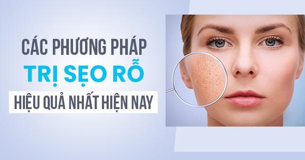 So sánh chi phí và hiệu quả của các phương pháp trị sẹo rỗ