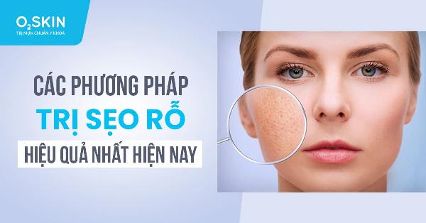 So sánh hiệu quả của các phương pháp điều trị sẹo rỗ khác nhau