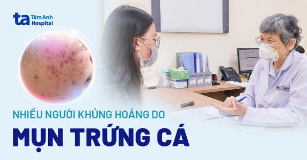 Ảnh hưởng tâm lý của người bị sẹo mụn