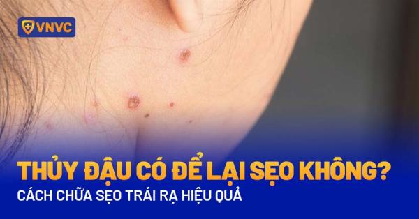 Thẩm mỹ viện Phú Xuân trị sẹo rỗ Vũng Tàu