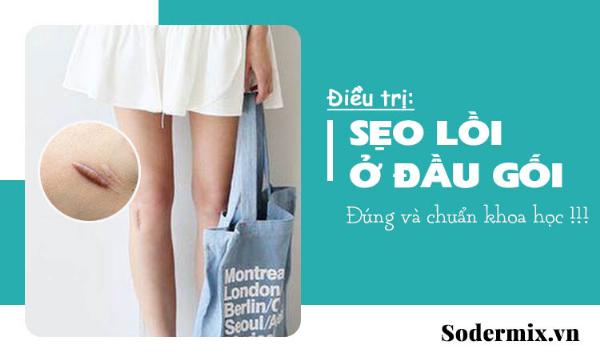 Thợ xăm hình chuyên nghiệp xăm hình che sẹo lồi