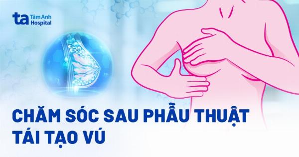 Biểu đồ thời gian khuyến nghị kiêng hút pod sau nâng mũi theo từng giai đoạn phục hồi