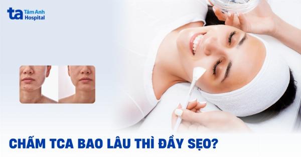 Thời gian để thấy kết quả sau khi trị sẹo lõm bằng TCA